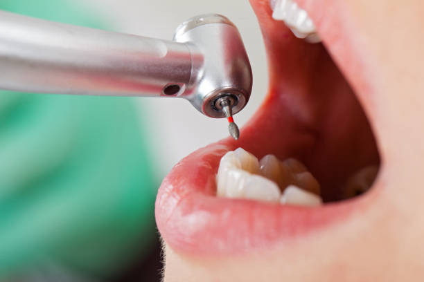 Best Pediatric Emergency Dentist in Pine Manor, FL